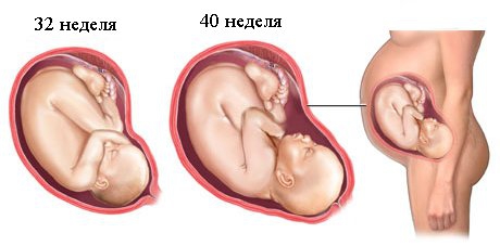 Чаще всего роды происходят на 37-40 неделе! Будь готова!